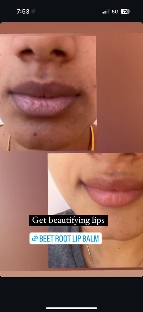 Beetroot lip balm