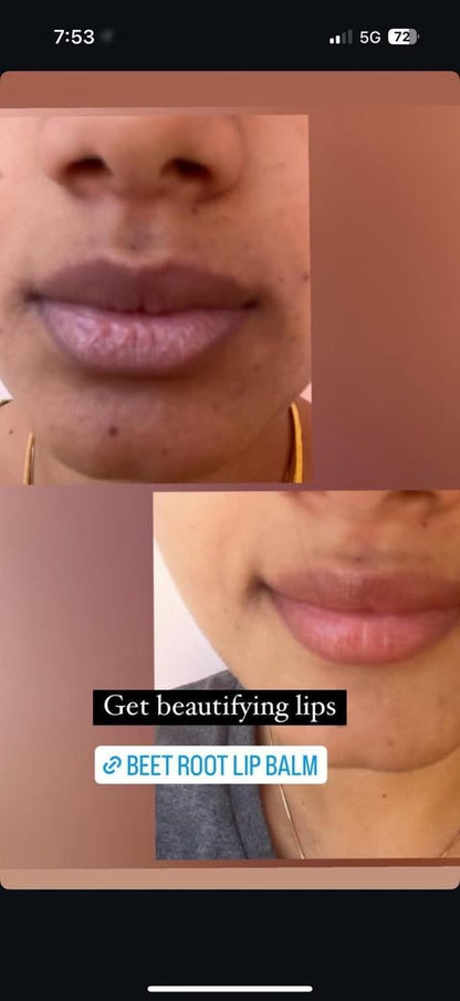 Beetroot lip balm