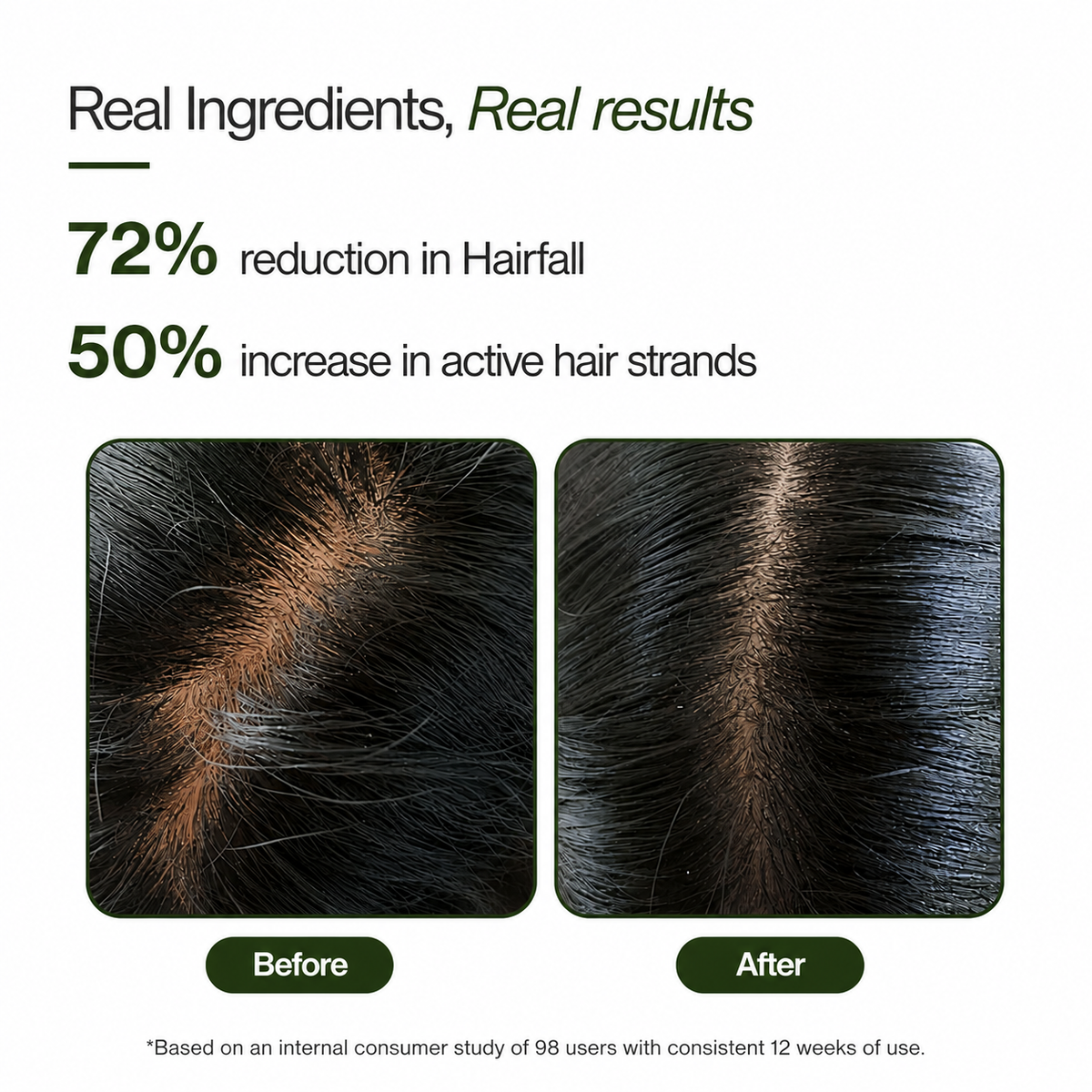 Hair Growth Serum with Rosemary and 2% Biotin