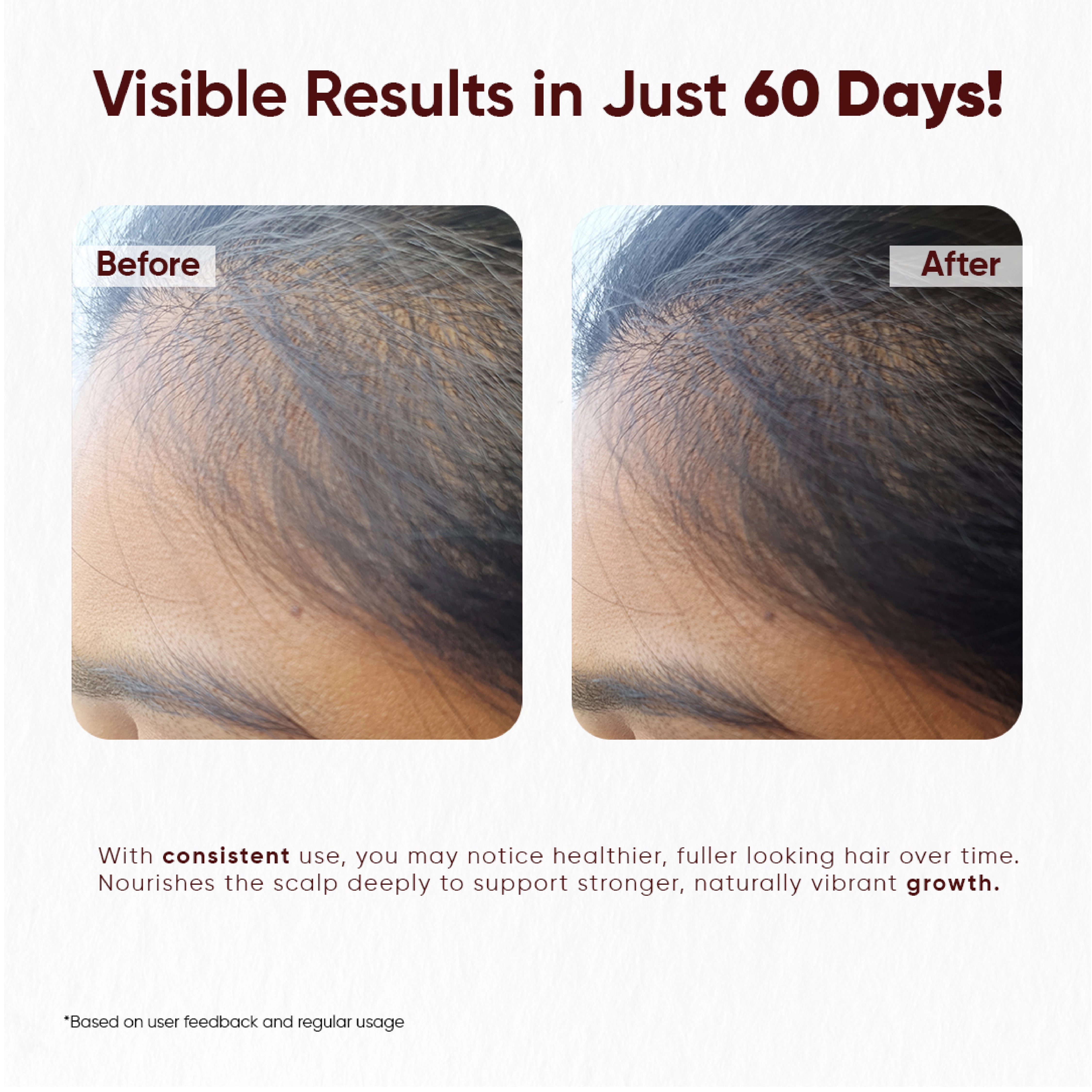Hair Growth Oil