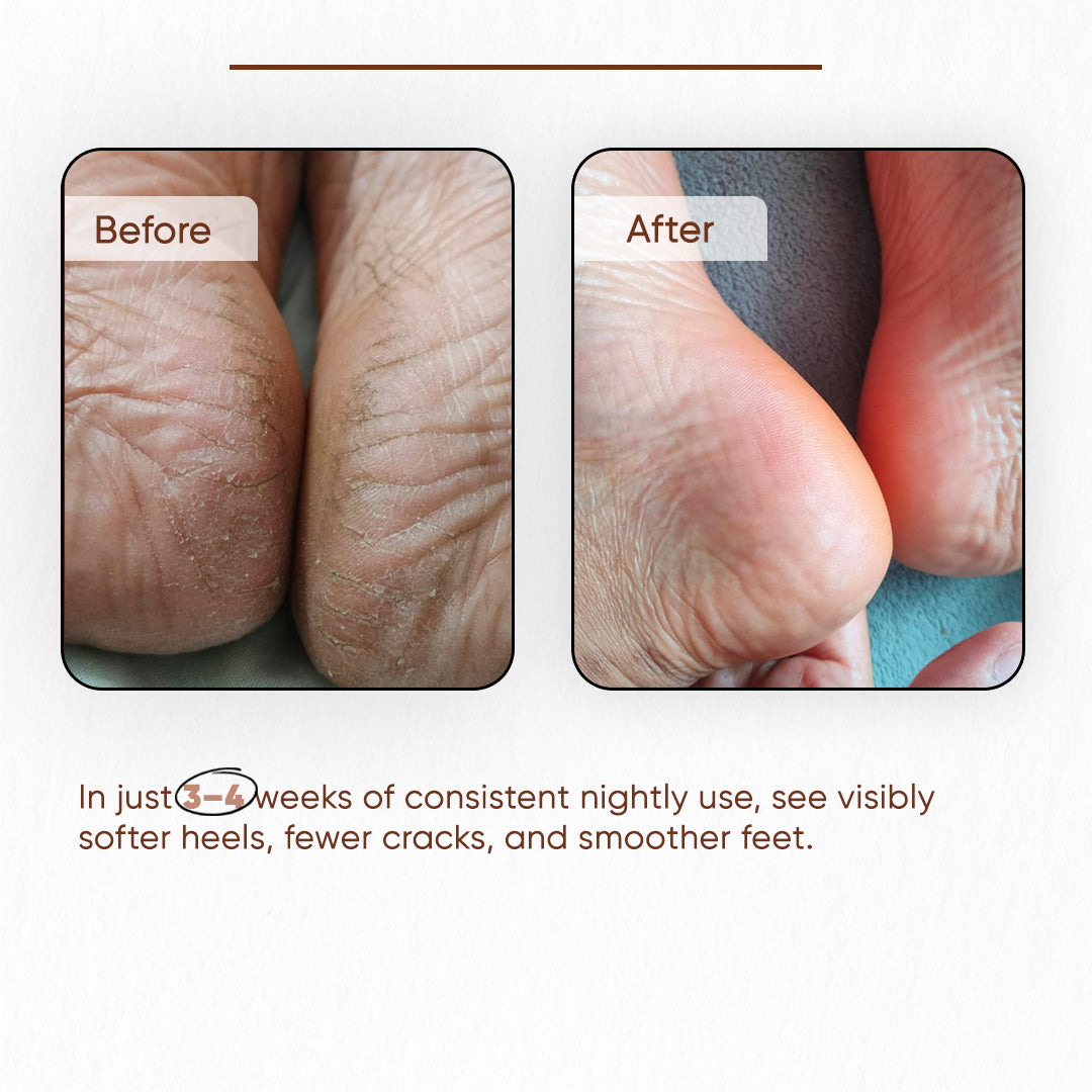 Crack Care Foot butter