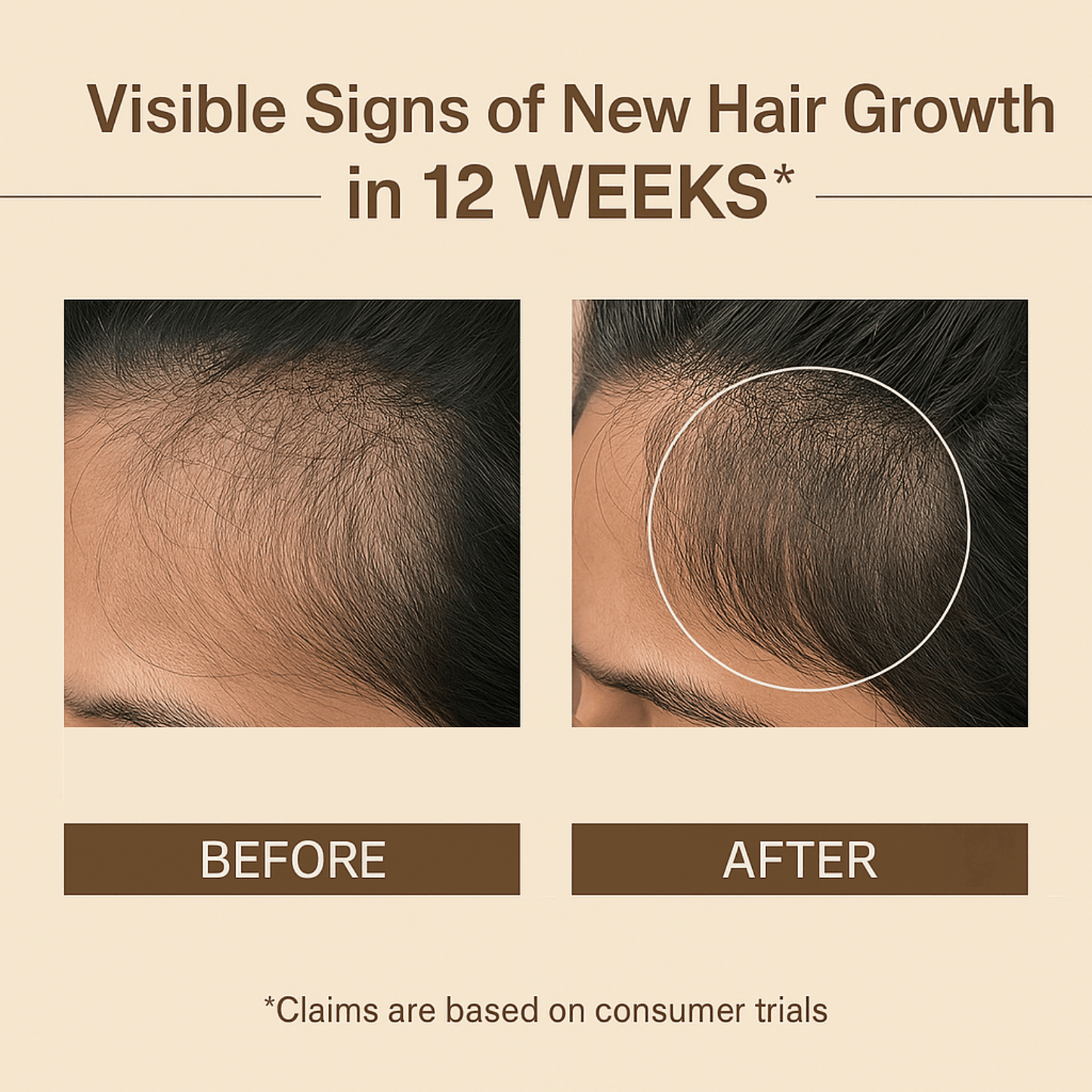Hair Growth Oil